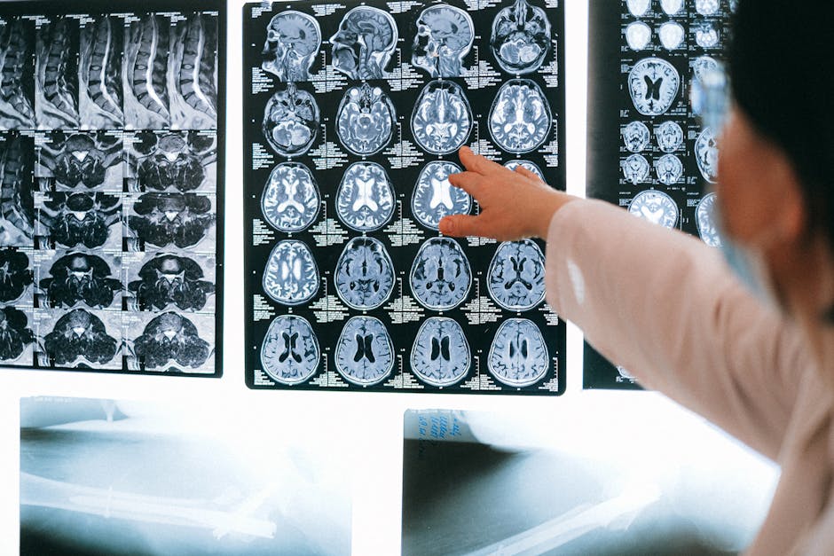 Everything You Need to Know About Hiring a Brain Injury Lawyer 3 brain injury lawyer