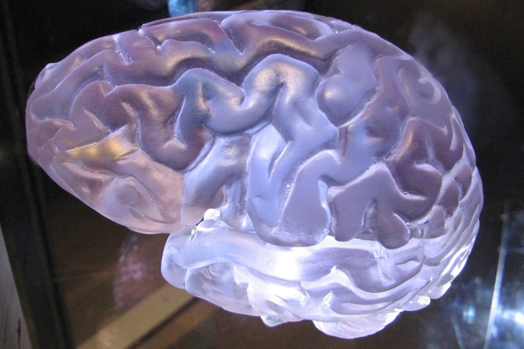 Brain Injury Lawsuits in Santa Ana. What You Need to Know Before You Settle 6 brain injury lawsuit