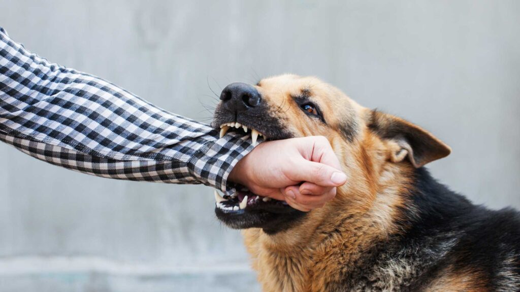 Dog Bite Lawyer in Santa Ana, CA: The Complete 2026 Legal Guide 1 Dog Bite Lawyer in Santa Ana, CA: The Complete 2026 Legal Guide