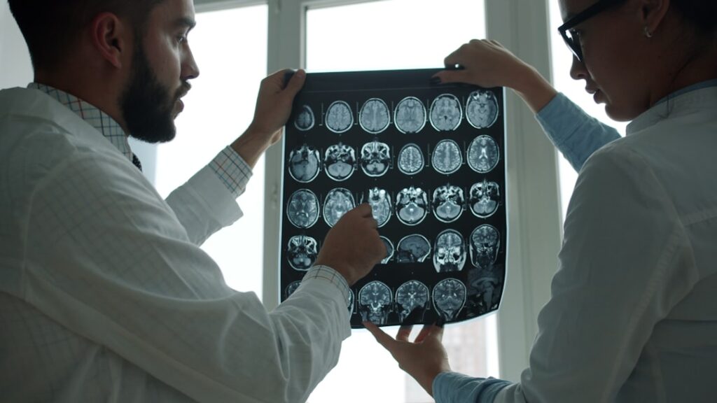 mild traumatic brain injury settlements