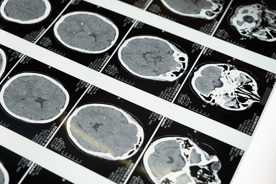 Santa Ana Injury Claims: Pain, Suffering, and Proven Results 2 brain trauma motorcycle wreck santa ana