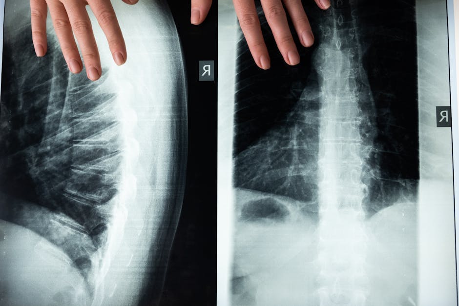 Santa Ana Spinal Cord Injury Lawyers: Expert Legal Help Guide 4 spinal cord injury lawyer Santa Ana
