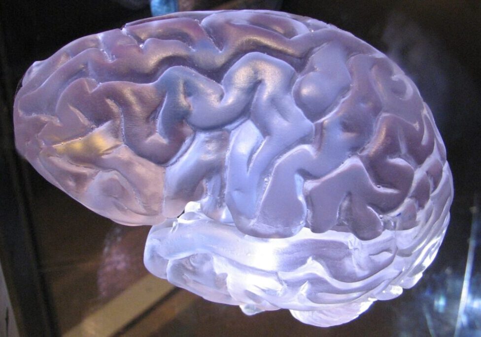 brain injury lawsuit