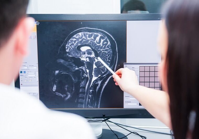 Traumatic brain injury lawyer in Orange County CA