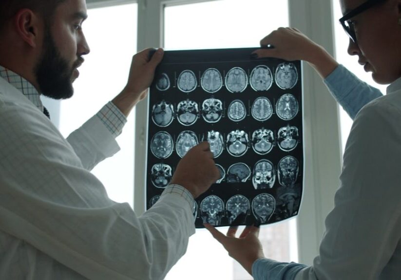 mild traumatic brain injury settlements